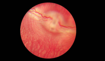 Rabbit Fundus2