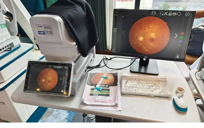 fundus camera working