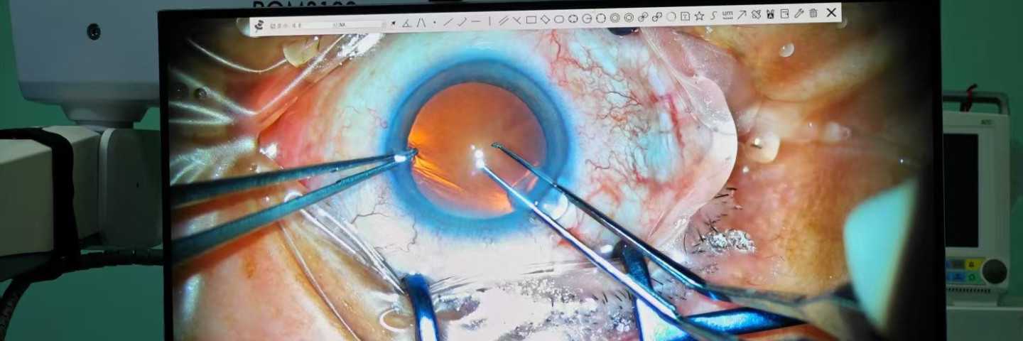 surgery video