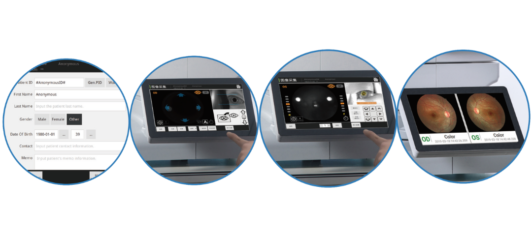 Automatic fudnus camera