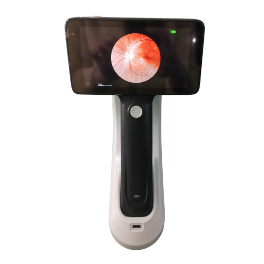 portable fundus camera new