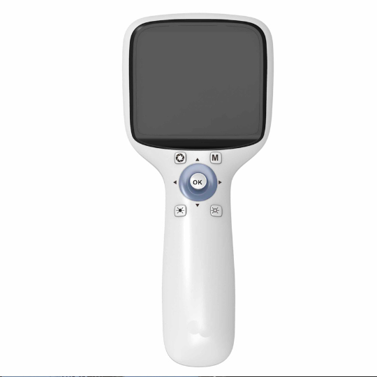 portable fundus camera