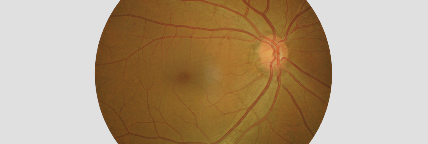 smart fundus imaging