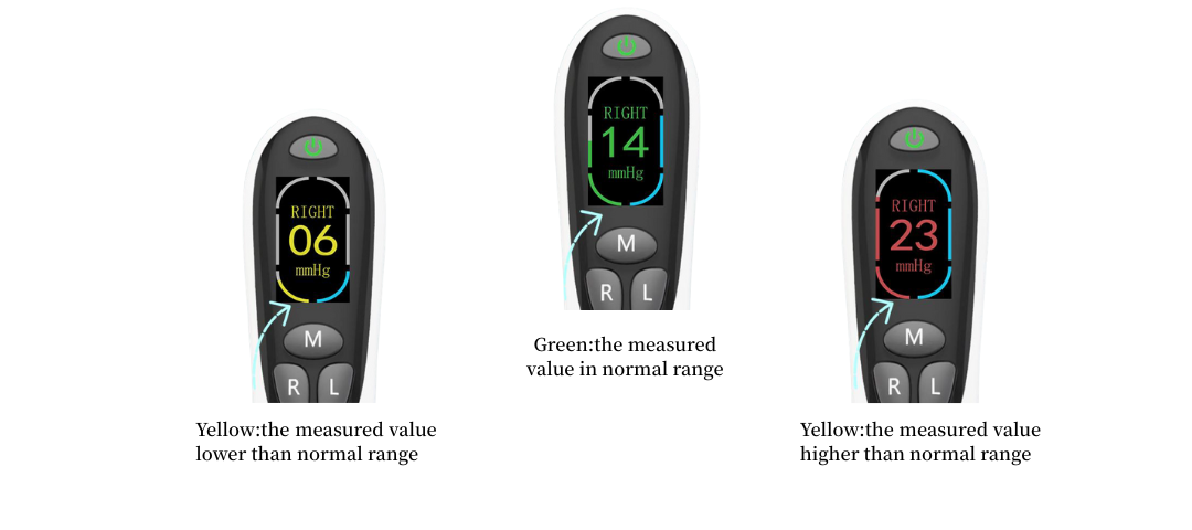 IOP measuring indicator